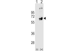 Western Blotting (WB) image for anti-FYN Oncogene Related To SRC, FGR, YES (FYN) antibody (ABIN3003445) (FYN Antikörper)
