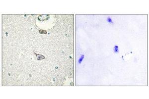 Immunohistochemistry (IHC) image for anti-Cell Adhesion Molecule 4 (CADM4) (C-Term) antibody (ABIN1850236) (Cell Adhesion Molecule 4 Antikörper  (C-Term))