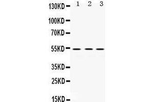 Western Blotting (WB) image for anti-Matrix Metallopeptidase 1 (Interstitial Collagenase) (MMP1) (AA 194-231), (Middle Region) antibody (ABIN3043405)