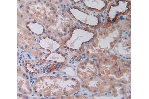 IHC-P analysis of kidney tissue, with DAB staining. (SLC12A3 Antikörper  (AA 3-146))