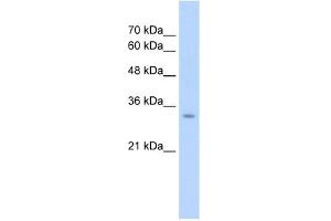 WB Suggested Antibody Titration:  2. (GLS2 Antikörper  (Middle Region))