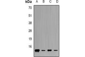 Western blot analysis of Frataxin expression in Jurkat (A), K562 (B), mouse heart (C), mouse liver (D) whole cell lysates.