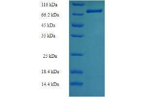 SDS-PAGE (SDS) image for Thioredoxin Reductase 2 (TXNRD2) (AA 37-524) protein (His-SUMO Tag) (ABIN5711914)