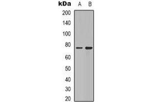 Western blot analysis of Synapsin 1 expression in Hela (A), mouse brain (B) whole cell lysates.