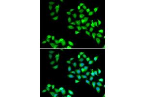 Immunofluorescence analysis of HeLa cell using NNMT antibody.