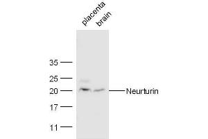 Mouse placenta and heart lysates probed with Rabbit Anti-Neurturin Polyclonal Antibody, Unconjugated  at 1:500 for 90 min at 37˚C. (Neurturin Antikörper  (AA 151-197))