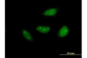 Immunofluorescence of purified MaxPab antibody to NOL6 on HeLa cell. (Nucleolar Protein 6 Antikörper  (AA 1-200))