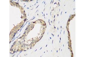 Immunohistochemistry (Paraffin-embedded Sections) (IHC (p)) image for anti-Methyltransferase Like 7A (METTL7A) antibody (ABIN7264251)