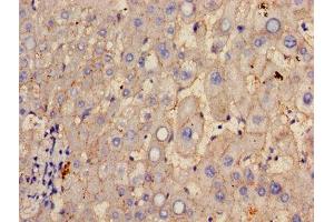 Immunohistochemistry of paraffin-embedded human liver tissue using ABIN7154060 at dilution of 1:100 (GGT1 Antikörper  (AA 13-225))