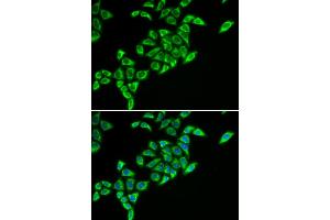 Immunofluorescence analysis of HeLa cells using DLAT antibody. (DLAT Antikörper)