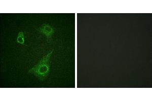 P-peptide - +Western blot analysis of extracts from K562 cells, using Epo-R (Phospho-Tyr368) antibody. (EPOR Antikörper  (pTyr368))