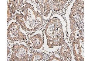 IHC analysis of COMT using anti-COMT antibody (ABIN7601948). (COMT Antikörper  (AA 52-271))