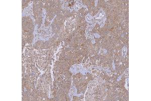 IHC analysis of WDR44 using anti-WDR44 antibody (ABIN7600394). (WDR44 Antikörper  (AA 188-913))