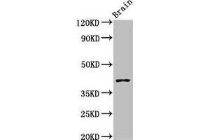 Western Blot Positive WB detected in: Mouse brain tissue All lanes: SEPT3 antibody at 3 μg/mL Secondary Goat polyclonal to rabbit IgG at 1/50000 dilution Predicted band size: 41, 10 kDa Observed band size: 41 kDa (Septin 3 Antikörper  (AA 238-358))