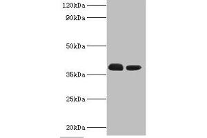 Western blot All lanes: Three-prime repair exonuclease 1 antibody at 3 μg/mL Lane 1: Hela whole cell lysate Lane 2: HepG2 whole cell lysate Secondary Goat polyclonal to rabbit IgG at 1/10000 dilution Predicted band size: 39, 33, 34 kDa Observed band size: 39 kDa (TREX1 Antikörper  (AA 1-270))
