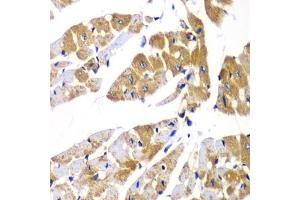 Immunohistochemistry of paraffin-embedded mouse heart using PPP1R12A Antibody (ABIN5974045) at dilution of 1/100 (40x lens). (PPP1R12A Antikörper)