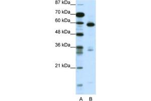 Western Blotting (WB) image for anti-Methyl-CpG Binding Domain Protein 1 (MBD1) antibody (ABIN2462036) (MBD1 Antikörper)