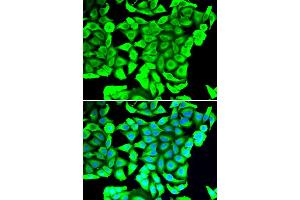 Immunofluorescence analysis of MCF-7 cells using DCD antibody (ABIN5974382). (Dermcidin Antikörper)