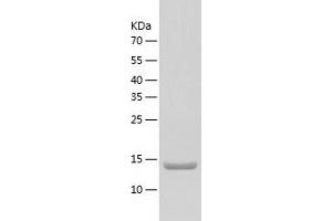 Western Blotting (WB) image for Chemokine (C-C Motif) Ligand 25 (CCL25) (AA 24-144) protein (His tag) (ABIN7122292)