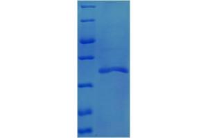 SDS-PAGE (SDS) image for Transforming Growth Factor, beta 1 (TGFB1) (AA 2-259) protein (His tag) (ABIN1459217)