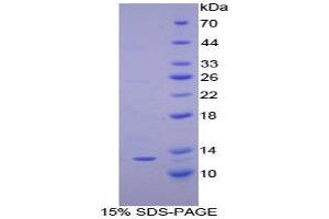 SDS-PAGE (SDS) image for Chemokine (C-X-C Motif) Ligand 10 (CXCL10) (AA 22-98) protein (His tag) (ABIN1080030) (CXCL10 Protein (AA 22-98) (His tag))