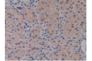 Detection of IL17RE in Rat Kidney Tissue using Polyclonal Antibody to Interleukin 17 Receptor E (IL17RE) (IL17RE Antikörper  (AA 457-626))