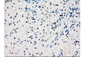 Immunohistochemical staining of paraffin-embedded endometrium tissue using anti-PORmouse monoclonal antibody. (POR Antikörper)