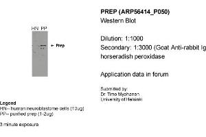 Western Blotting (WB) image for anti-Prolyl Endopeptidase (PREP) (Middle Region) antibody (ABIN2786689) (PREP Antikörper  (Middle Region))