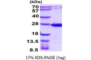 SDS-PAGE (SDS) image for ADP-Ribosylation Factor-Like 14 (ARL14) (AA 1-192) protein (His tag) (ABIN667563)