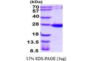 SDS-PAGE (SDS) image for ADP-Ribosylation Factor-Like 14 (ARL14) (AA 1-192) protein (His tag) (ABIN667563) (ARL14 Protein (AA 1-192) (His tag))