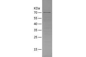 Western Blotting (WB) image for Cereblon (CRBN) (AA 1-442) protein (His-IF2DI Tag) (ABIN7122245)