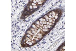 Immunohistochemistry (IHC) image for anti-Junction Plakoglobin (JUP) (C-Term) antibody (ABIN6260497)