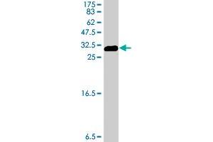 Western Blot detection against Immunogen (31. (ENO3 Antikörper  (AA 228-277))