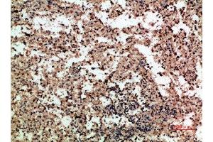 Immunohistochemical analysis of paraffin-embedded human-spleen, antibody was diluted at 1:200 (PF4 Antikörper  (AA 51-100))
