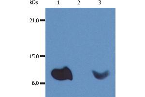 Western Blotting Western Blotting analysis (non-reducing conditions) of whole cell lysate of various cell lines using anti-human β2-microglobulin (B2M-01). (beta-2 Microglobulin Antikörper  (PE))