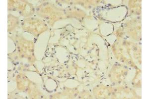 Immunohistochemistry of paraffin-embedded human kidney tissue using ABIN7154340 at dilution of 1:100 (PIGO Antikörper  (AA 219-420))