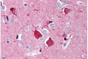 Human Brain, Cortex (formalin-fixed, paraffin-embedded) stained with NGFR antibody ABIN214454 at 5 ug/ml followed by biotinylated goat anti-rabbit IgG secondary antibody ABIN481713, alkaline phosphatase-streptavidin and chromogen. (NGFR Antikörper)