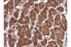 IHC-P Image Immunohistochemical analysis of paraffin-embedded human hepatoma, using ANGPTL3, antibody at 1:500 dilution. (ANGPTL3 Antikörper)