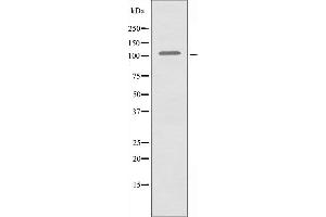 Western blot analysis of extracts from HeLa cells, using HXK1 antibody. (Hexokinase 1 Antikörper  (N-Term))