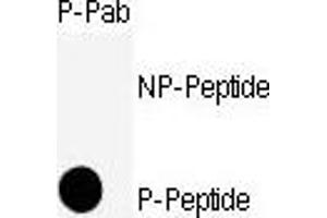 Dot blot analysis of anti-CDK11-S39 Phospho-specific Pab (ABIN389538 and ABIN2839585) on nitrocellulose membrane. (CDK1 Antikörper  (pSer39))