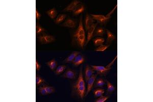 Immunofluorescence analysis of U-2 OS cells using Osteocalcin antibody (ABIN6134565, ABIN6137546, ABIN6137547 and ABIN6221793) at dilution of 1:100. (Osteocalcin Antikörper  (AA 1-100))