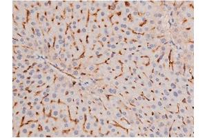 Immunohistochemistry (IHC) image for anti-Adducin 1 (Alpha) (ADD1) (pSer726) antibody (ABIN6255485)