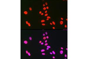 Immunofluorescence analysis of U-2 OS cells using hnRNP C Rabbit pAb (ABIN7267630) at dilution of 1:100 (40x lens). (HNRNPC Antikörper)