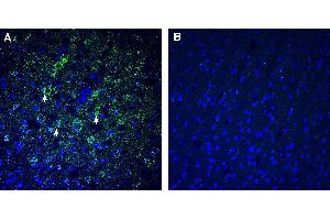 Expression of TMEM106B in mouse cortex.