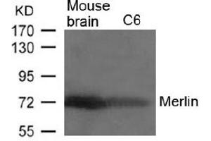 Image no. 2 for anti-Neurofibromin 2 (NF2) (AA 516-520) antibody (ABIN197520) (Merlin Antikörper  (AA 516-520))