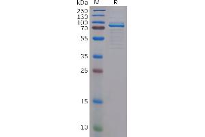 SDS-PAGE (SDS) image for Myeloproliferative Leukemia Virus Oncogene (MPL) (AA 26-490) protein (Fc Tag) (ABIN7490615)