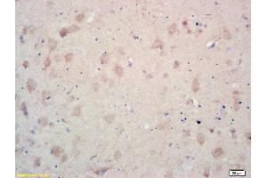 Formalin-fixed and paraffin embedded rat brain labeled with Rabbit Anti MCK10/CD167a/DDR1 Polyclonal Antibody, Unconjugated (ABIN671706) at 1:200 followed by conjugation to the secondary antibody and DAB staining (DDR1 Antikörper  (AA 21-120))
