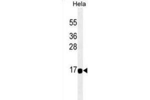 Western Blotting (WB) image for anti-Acyl-CoA Thioesterase 13 (ACOT13) antibody (ABIN2995329) (THEM2 Antikörper)