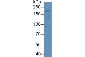 Western Blot; Sample: Rat Heart lysate; ;Primary Ab: 1µg/ml Rabbit Anti-Rat LEPR Antibody;Second Ab: 0. (Leptin Receptor Antikörper  (AA 238-375))