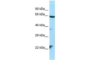 WB Suggested Anti-STK35 Antibody Titration: 1. (STK35 Antikörper  (N-Term))